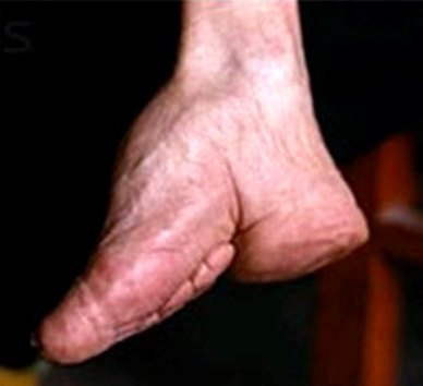 Bare foot