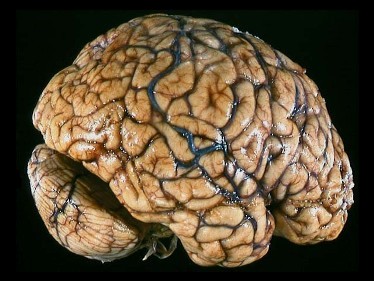 brain