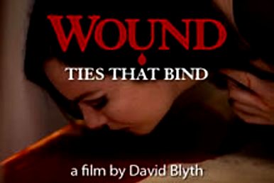 Wound